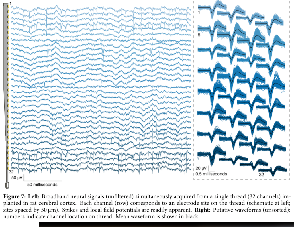 Neuralink Brainwaves